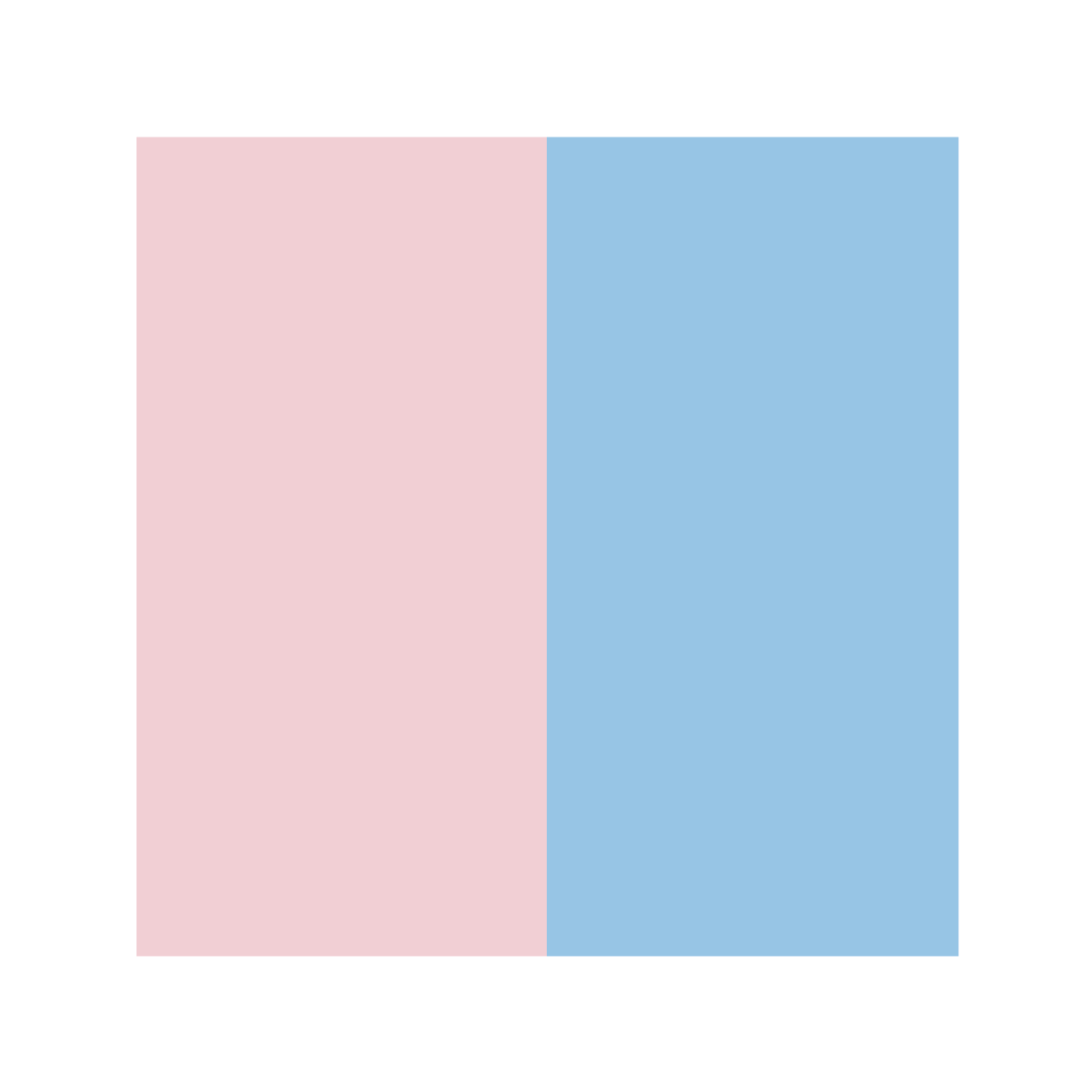 Epson Smooth Ink for SureColor F6470H Printers: Light Cyan (LC) and Light Magenta (LM)